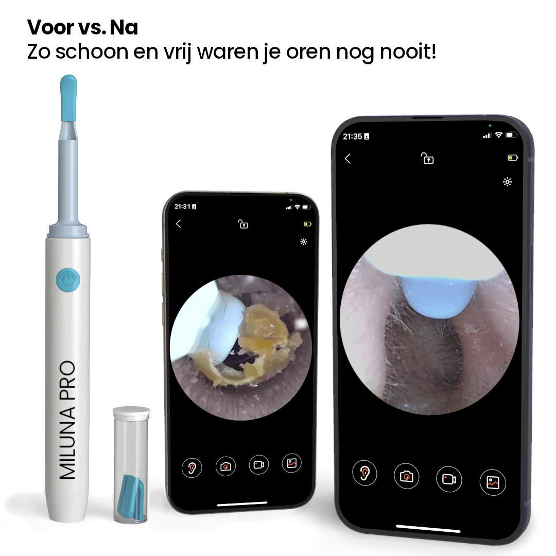 LuxeEar Pro | Smart øre renser med HD-kamera for optimal hygiejne-zarada.dk