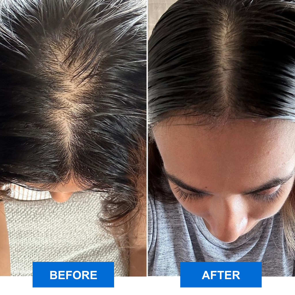 RelaxPro | massageapparat til to forskellige anvendelser-zarada.dk