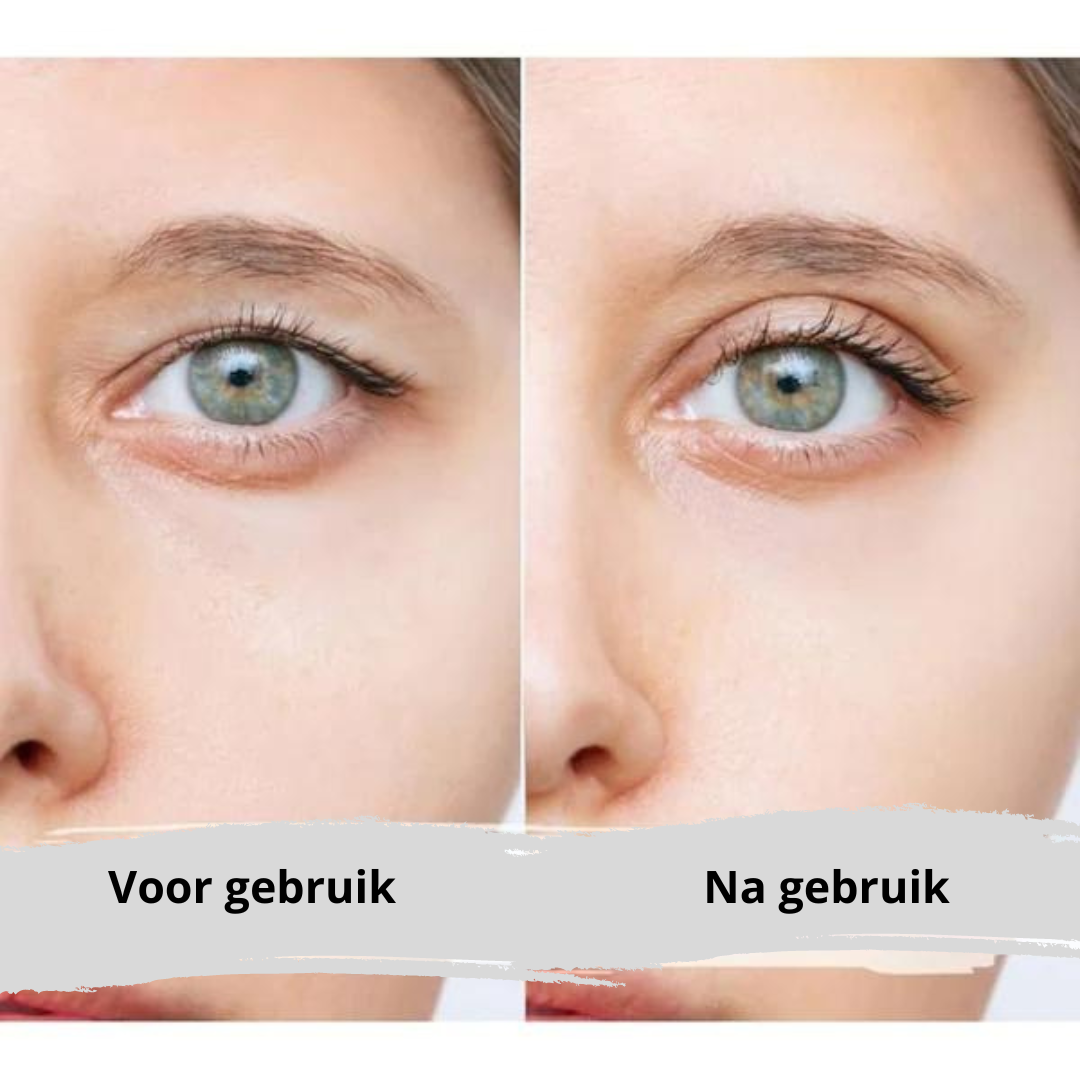 EyePerfection | Dobbelt Øjenlåg Tape mod hængende øjenlåg | Unisex-zarada.dk