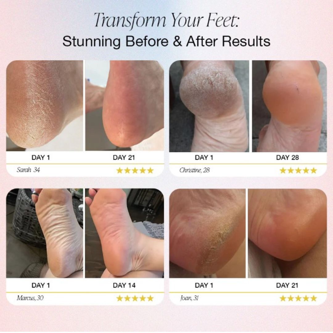 SmootherFeet Elektrisk Pedicure Værktøj | Professionel pleje lige ved hånden-zarada.dk