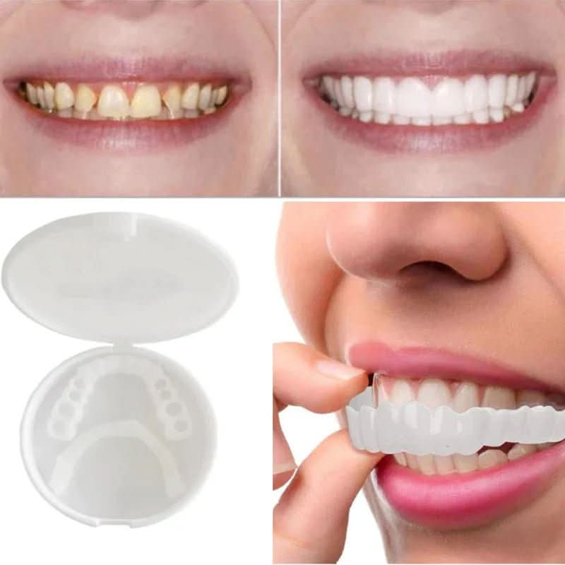 Voksne Tandfiner til Blændende Smil