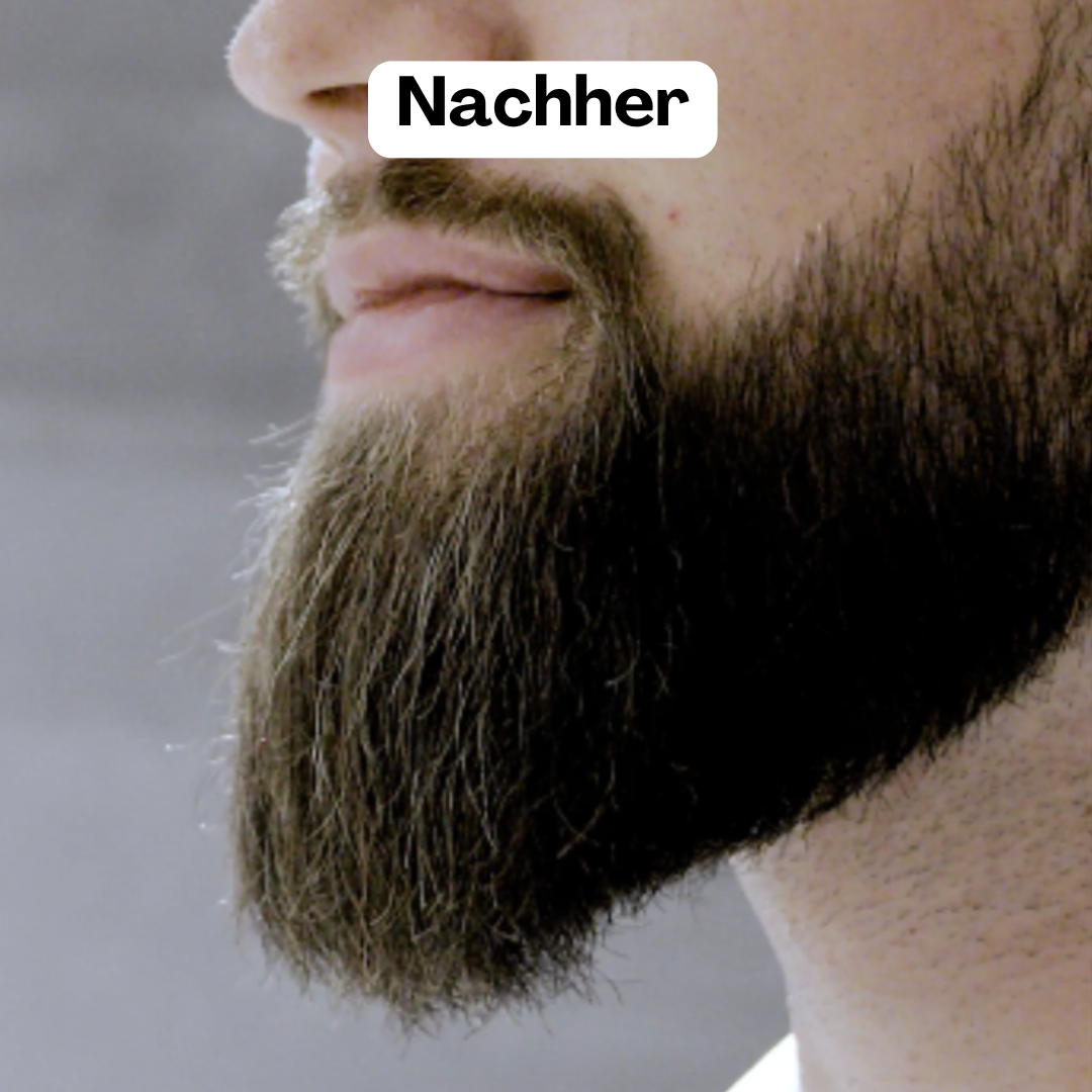 BeardMaster | Trådløs Negativ Ion Skæg Styler-zarada.dk