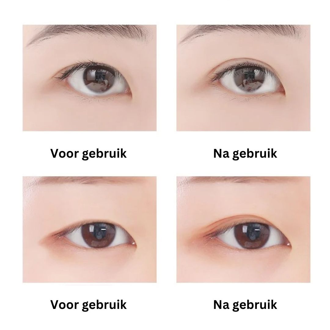 EyePerfection | Dobbelt Øjenlåg Tape mod hængende øjenlåg | Unisex-zarada.dk