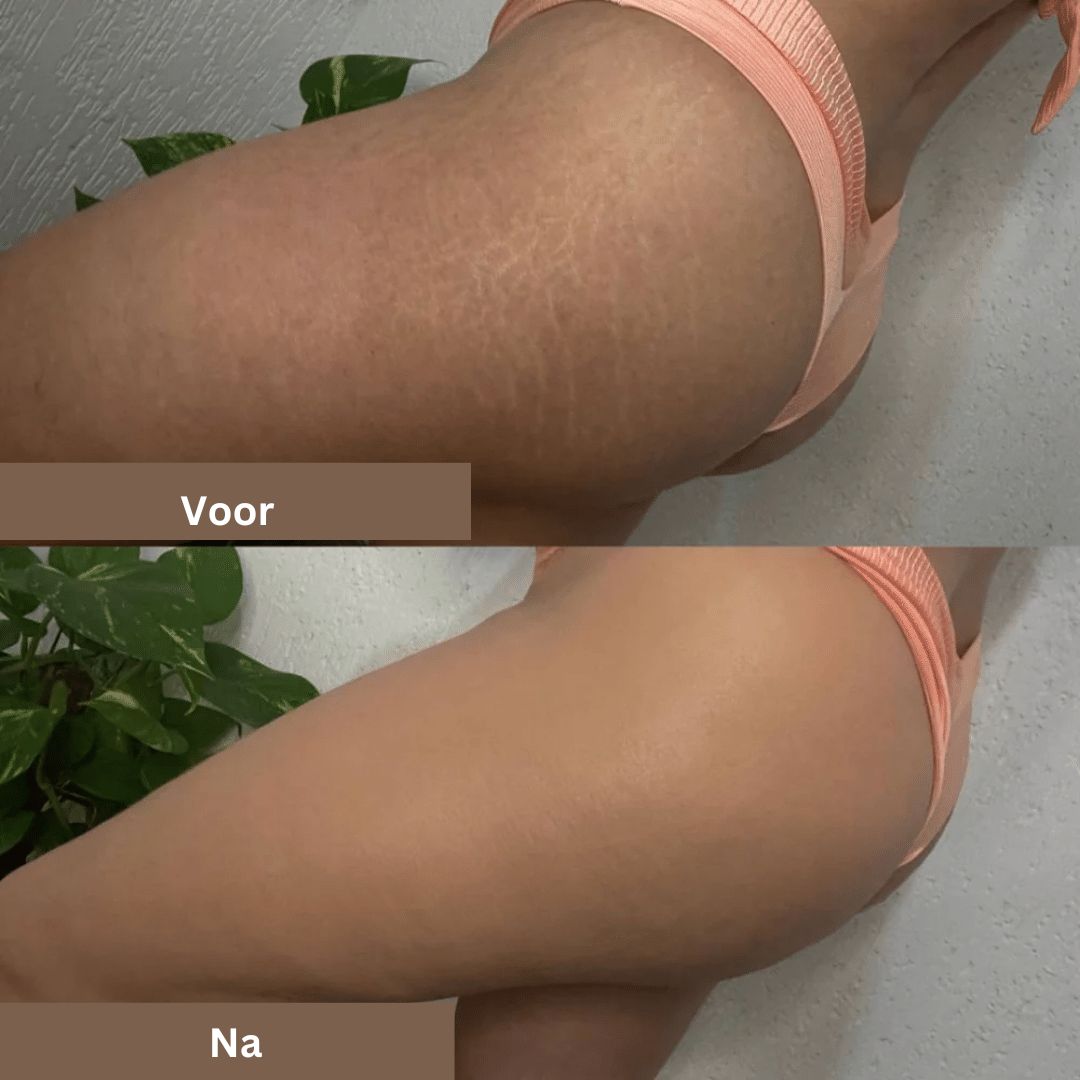 SmoothTone hudpleje | Til dækning af ar, årer, acne og solpletter-zarada.dk