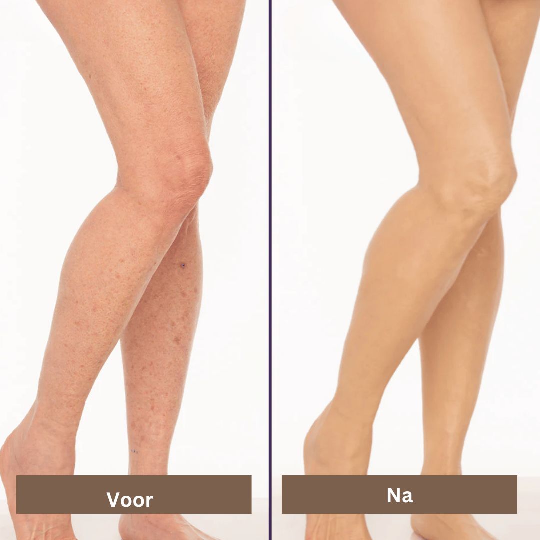SmoothTone hudpleje | Til dækning af ar, årer, acne og solpletter-zarada.dk