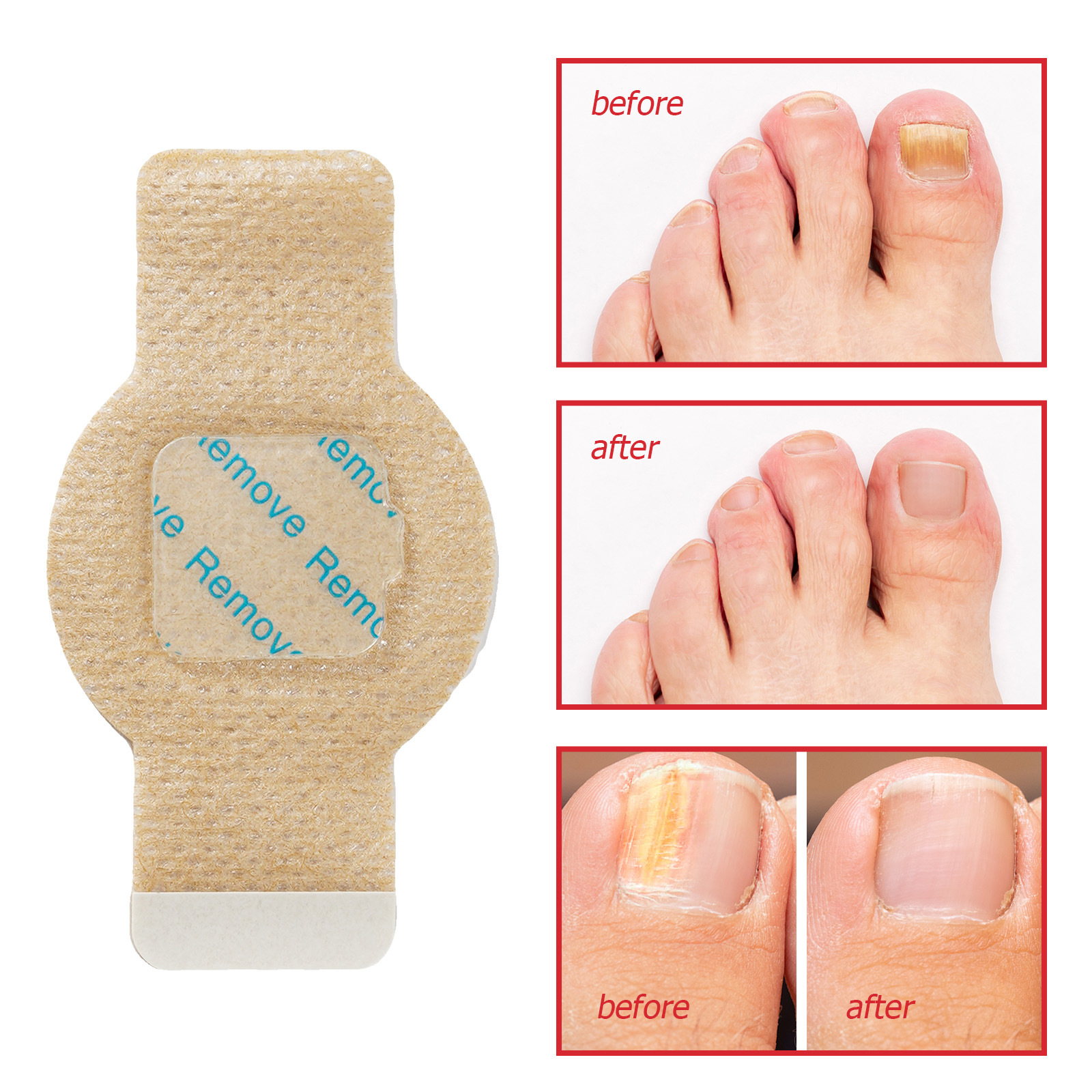 NailRevive™ – Få sunde negle tilbage