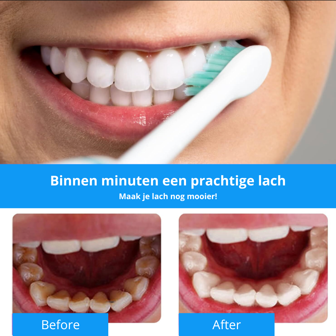 WhiteSmile™ – Et Strålende Smil på Få Minutter-zarada.dk