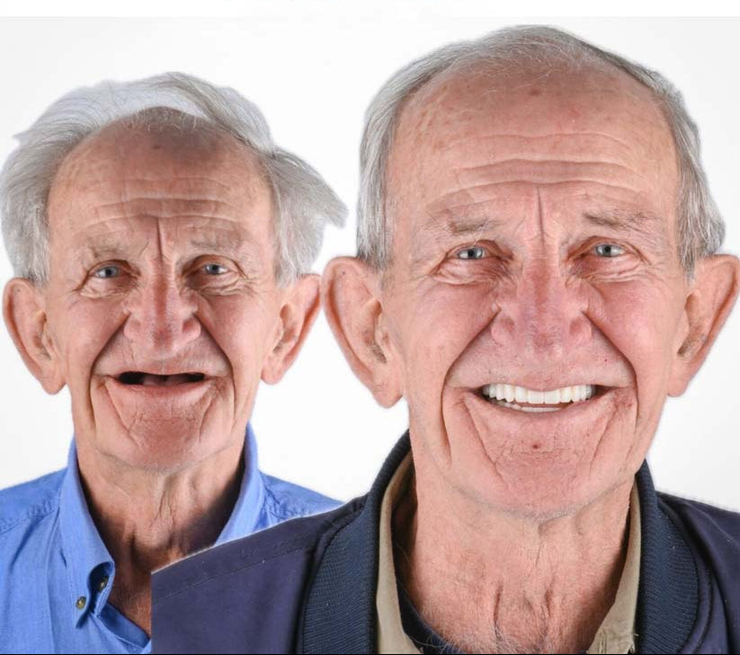 DentalKit - Naturligt udseende og følelse uden tandlægen!