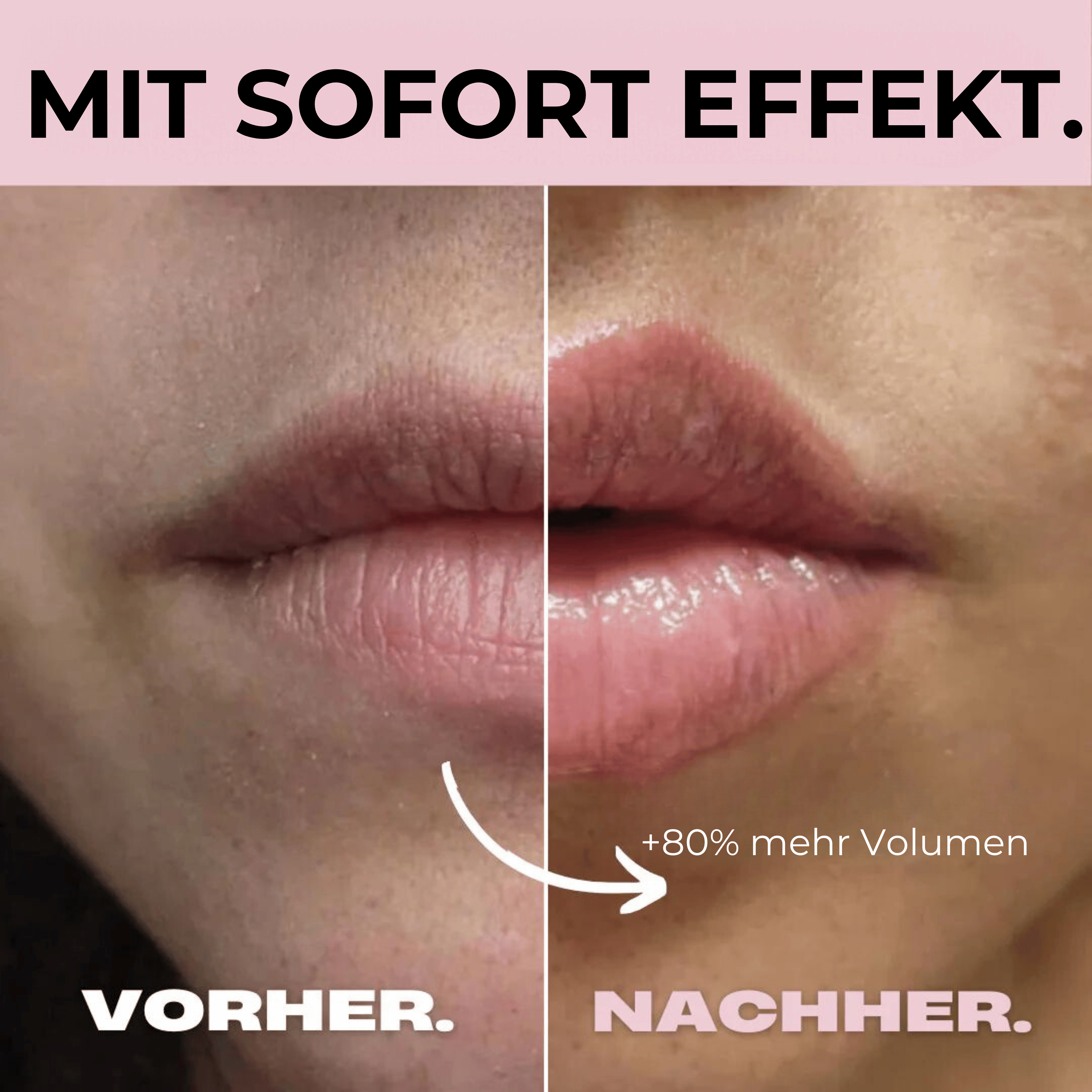 HydraGlow Micro Infusion Roller | fugtgiver, gør læberne fyldigere og revitaliserer-zarada.dk