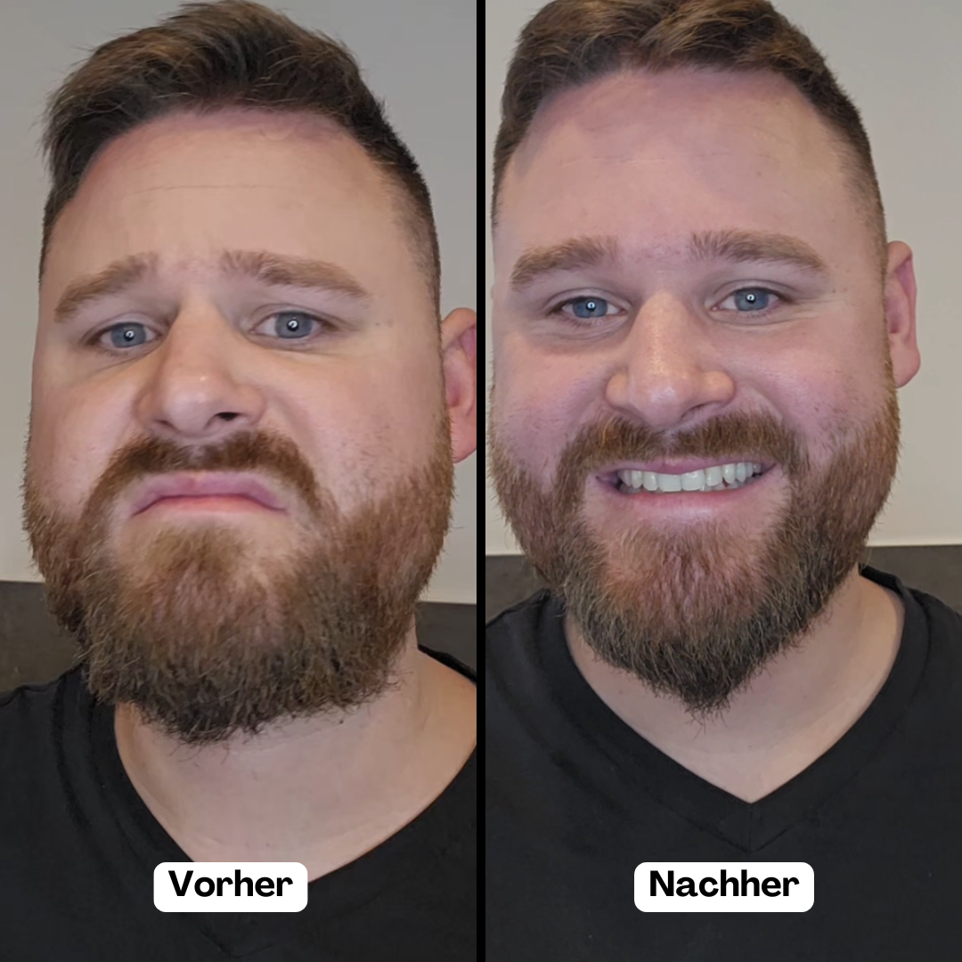 BeardMaster | Trådløs Negativ Ion Skæg Styler-zarada.dk