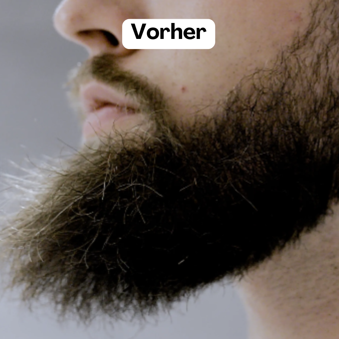BeardMaster | Trådløs Negativ Ion Skæg Styler-zarada.dk