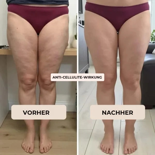 CompresFit | Premium Kompressionsleggings til forbedret ydeevne
